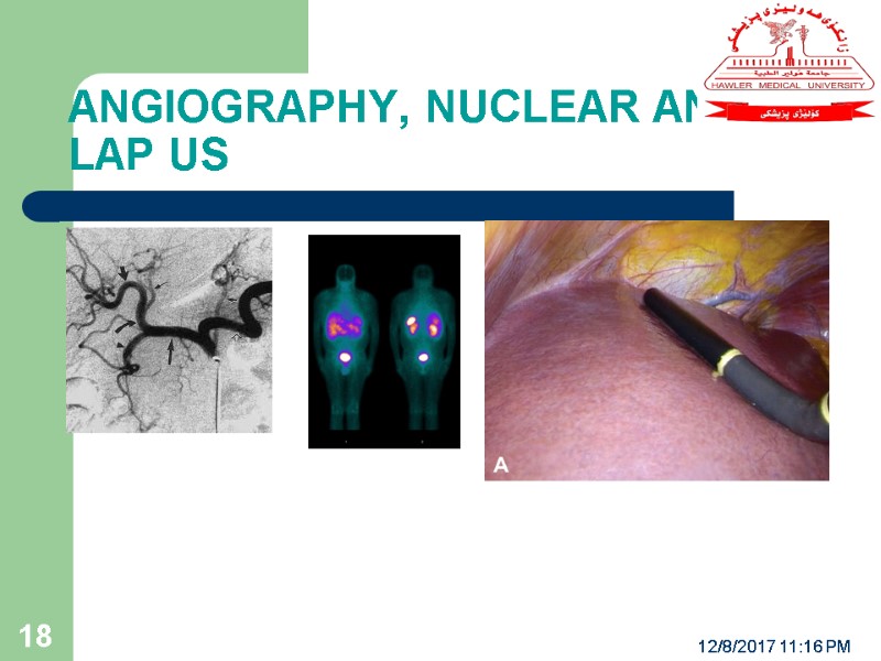 ANGIOGRAPHY, NUCLEAR AND LAP US 12/8/2017 11:16 PM 18